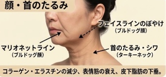 首のシワに効く成分と専用ケア メインビジュアル