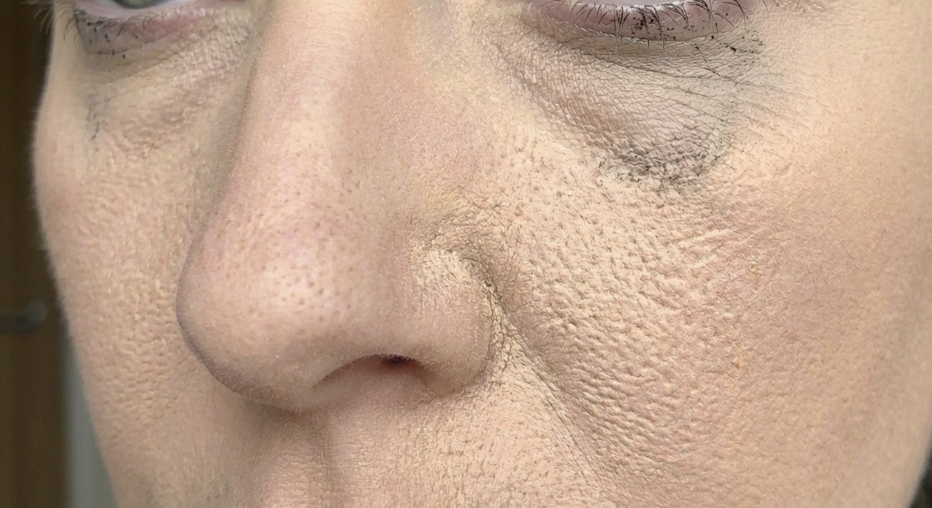 毛穴落ちの原因｜メイク崩れを防ぐ方法