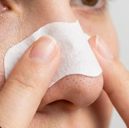 角栓タイプと色素沈着タイプの違いを示した図解