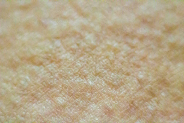 黄ぐすみの原因と対策｜透明感を取り戻す方法